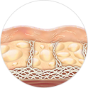 Before Ulthera: sagging skin and visible wrinkles